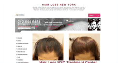 Desktop Screenshot of hairlossnewyork.org